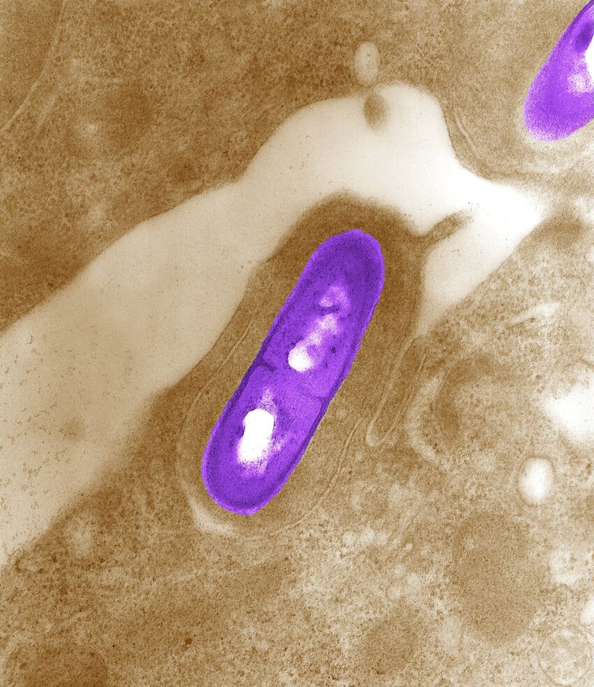 contamination Listeria